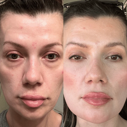 Lúmina™ Relaja, revitaliza y renueva tu mirada