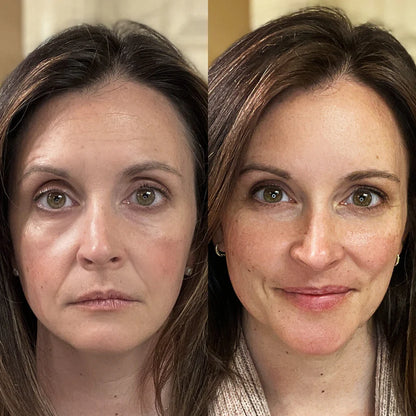 Dermalift™ Reafirma, tonifica y revitaliza tu piel