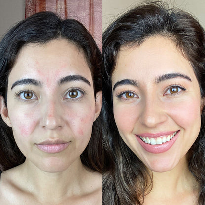 Dermalift™ Reafirma, tonifica y revitaliza tu piel