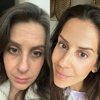 Dermalift™ Reafirma, tonifica y revitaliza tu piel